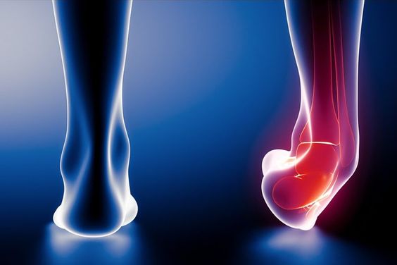Sprained Ankle: Symptoms, Types, Treatment and Recovery